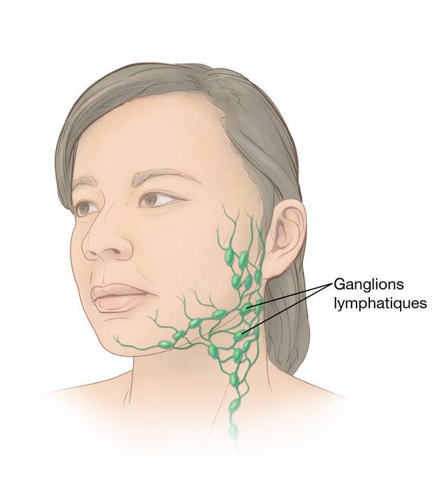 Tête et cou d'une femme, montrant les ganglions lymphatiques